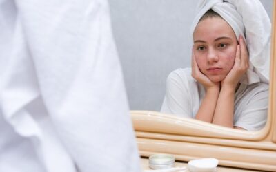 Jakie czynniki powodują suchość skóry?