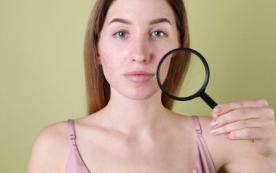 Co jest dobre na pękające naczynka i jak zadbać o cerę?