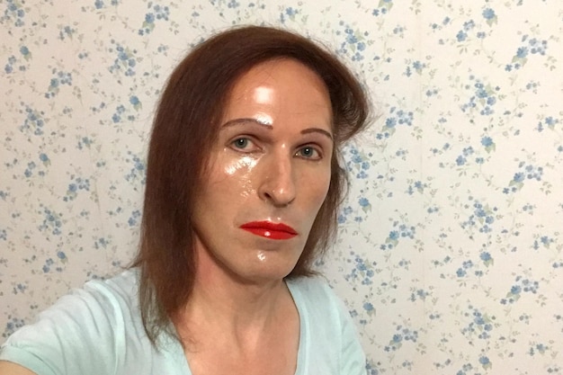 Jak zlikwidować popękane naczynka krwionośne na twarzy?